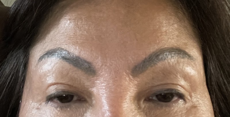 Removery Tattoo Removal & Fading photo 3