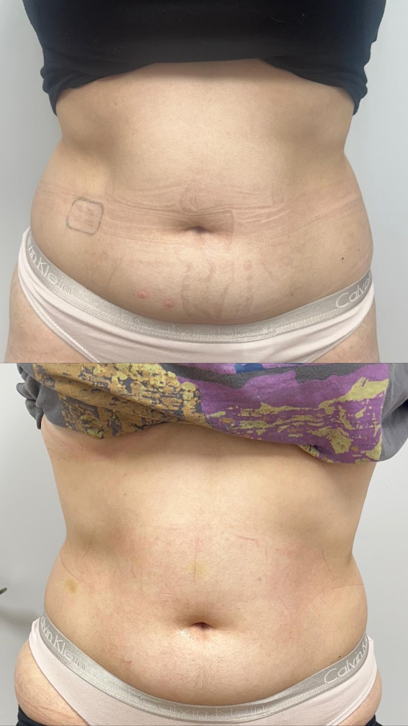 Dermavip photo 4