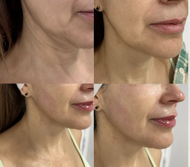 Dermavip photo 5