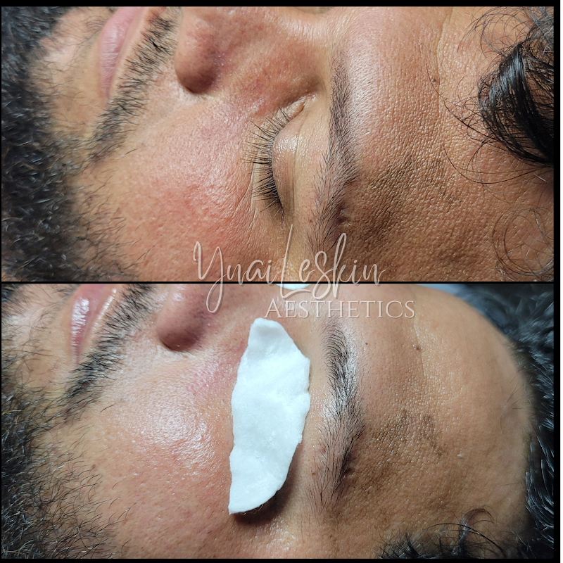 Photo of YnaiLeskin Aesthetics