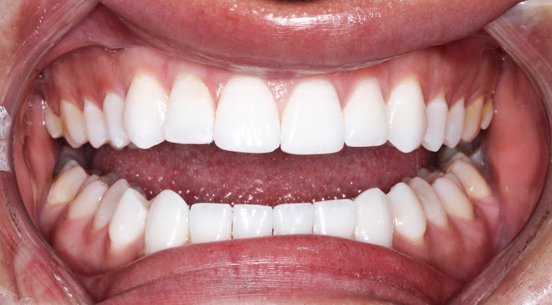 Lagemann Family Dentistry | Quality Family & Cosmetic Dentist in Mountain View and Los Altos photo 2