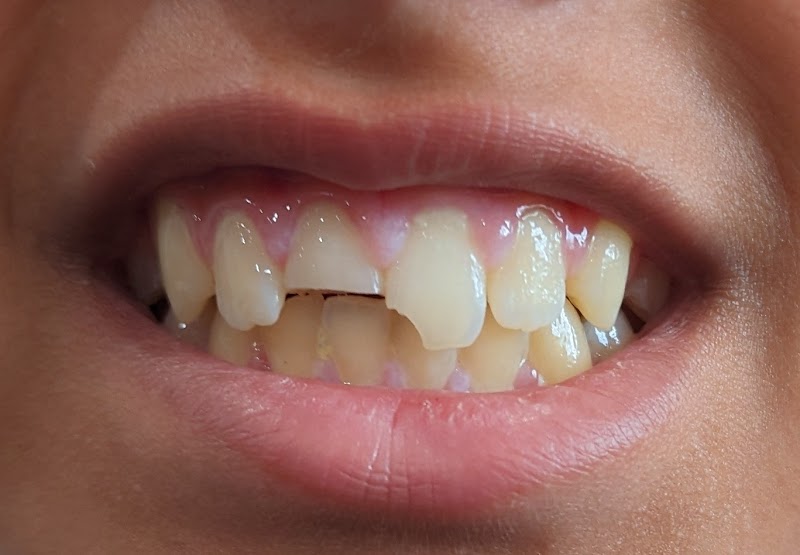 Orinda Family Dentistry photo 3