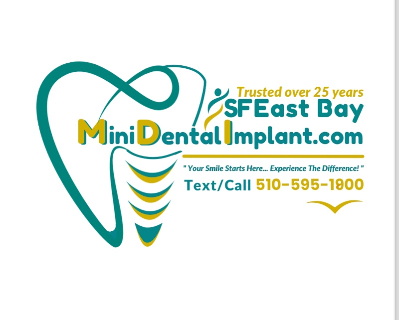 SF East Bay Mini Dental Implants photo 5