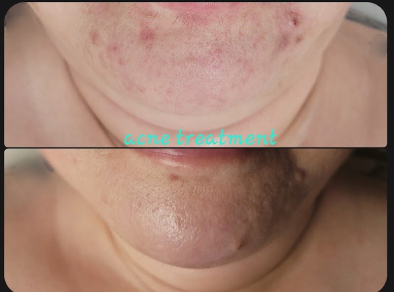 La bella skincare photo 5